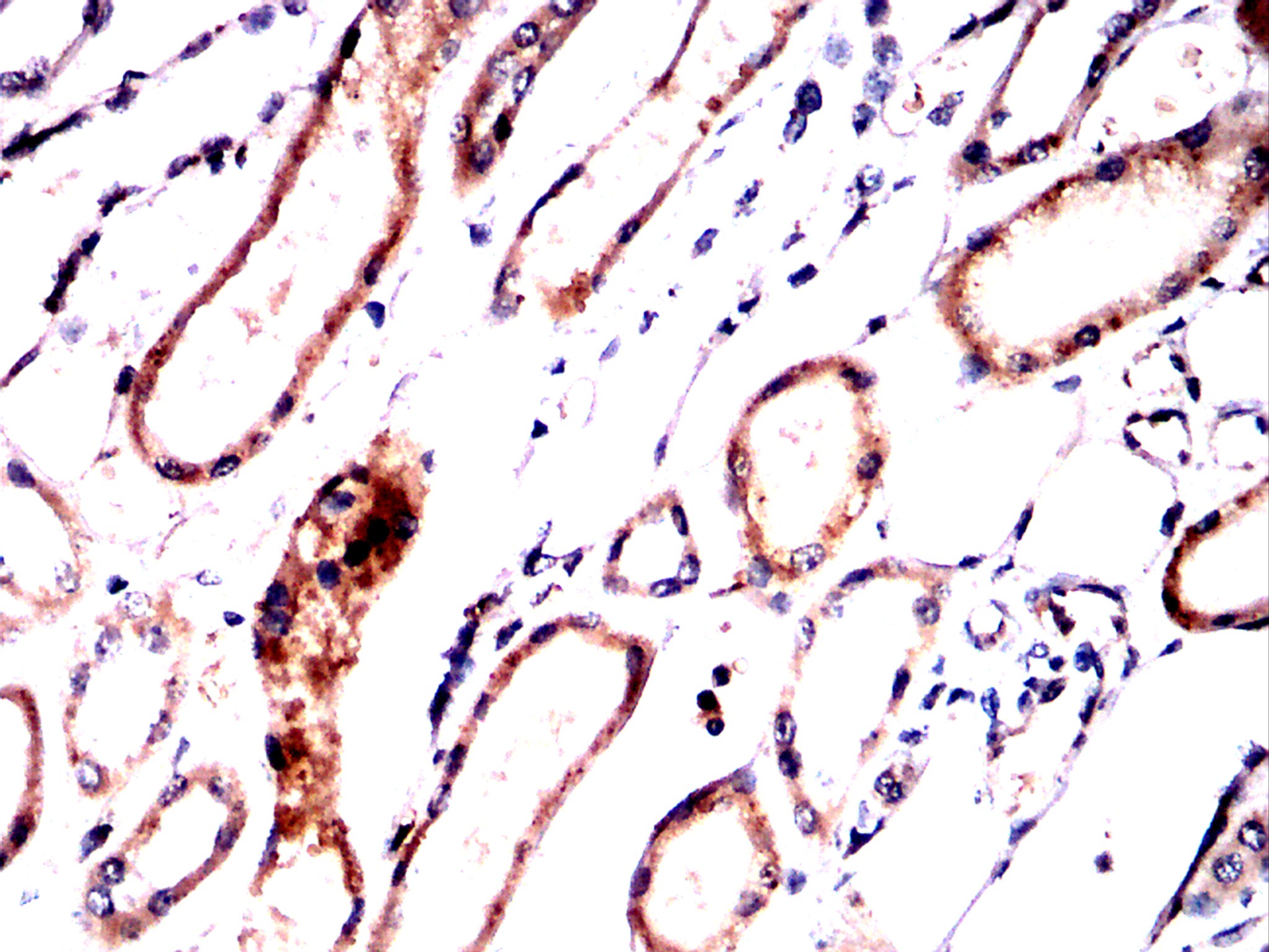 IHC 